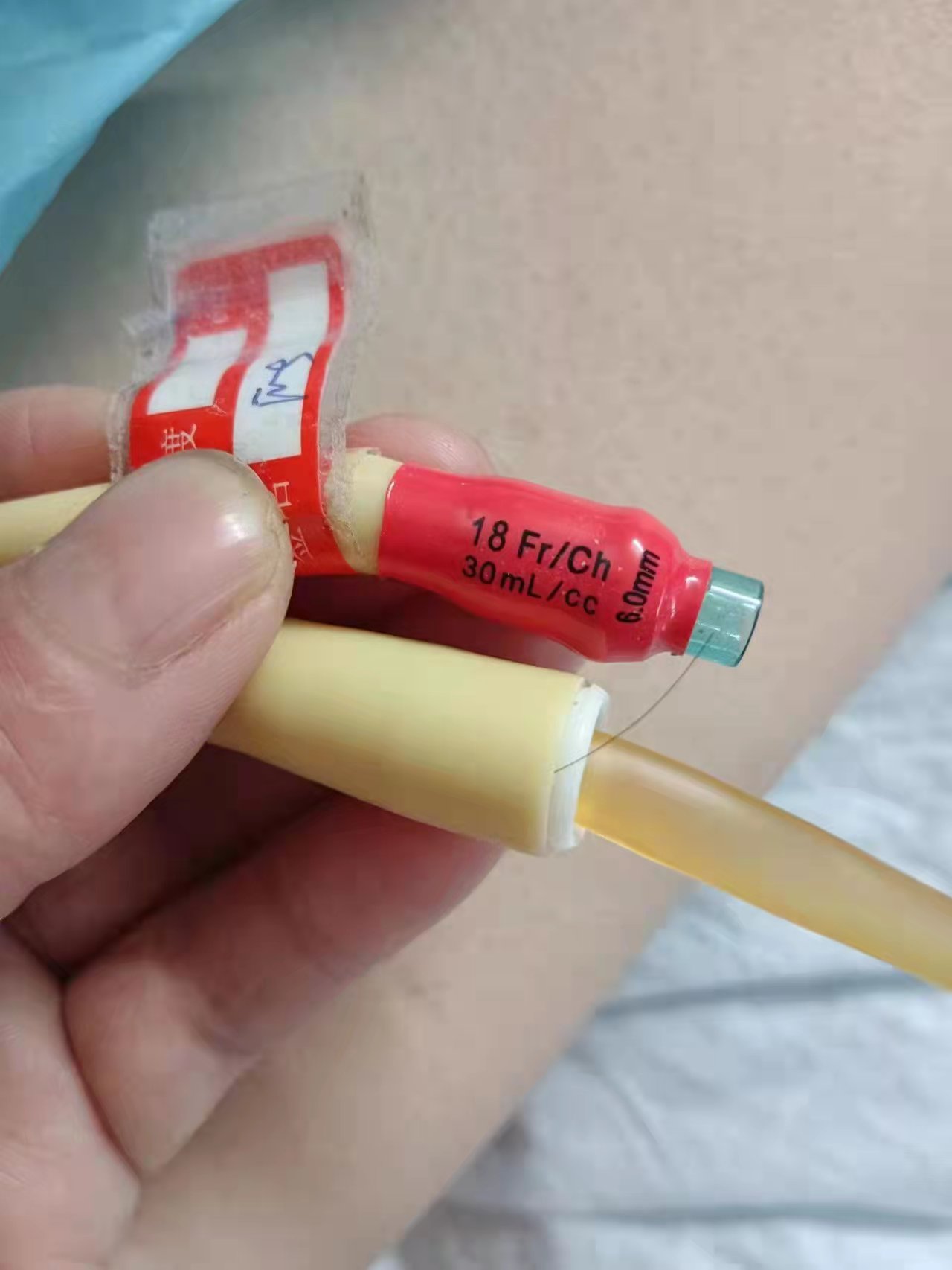 徐州上门输液打针